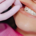 Pourquoi vos gencives saignent-elles ? Les causes les plus fréquentes et comment y remédier